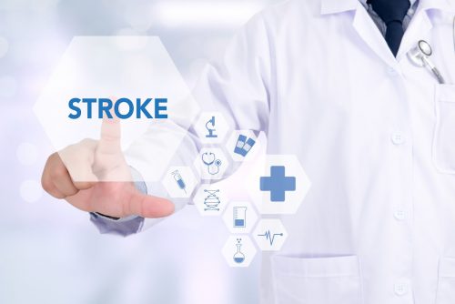 Can Stroke Affect Your Balance