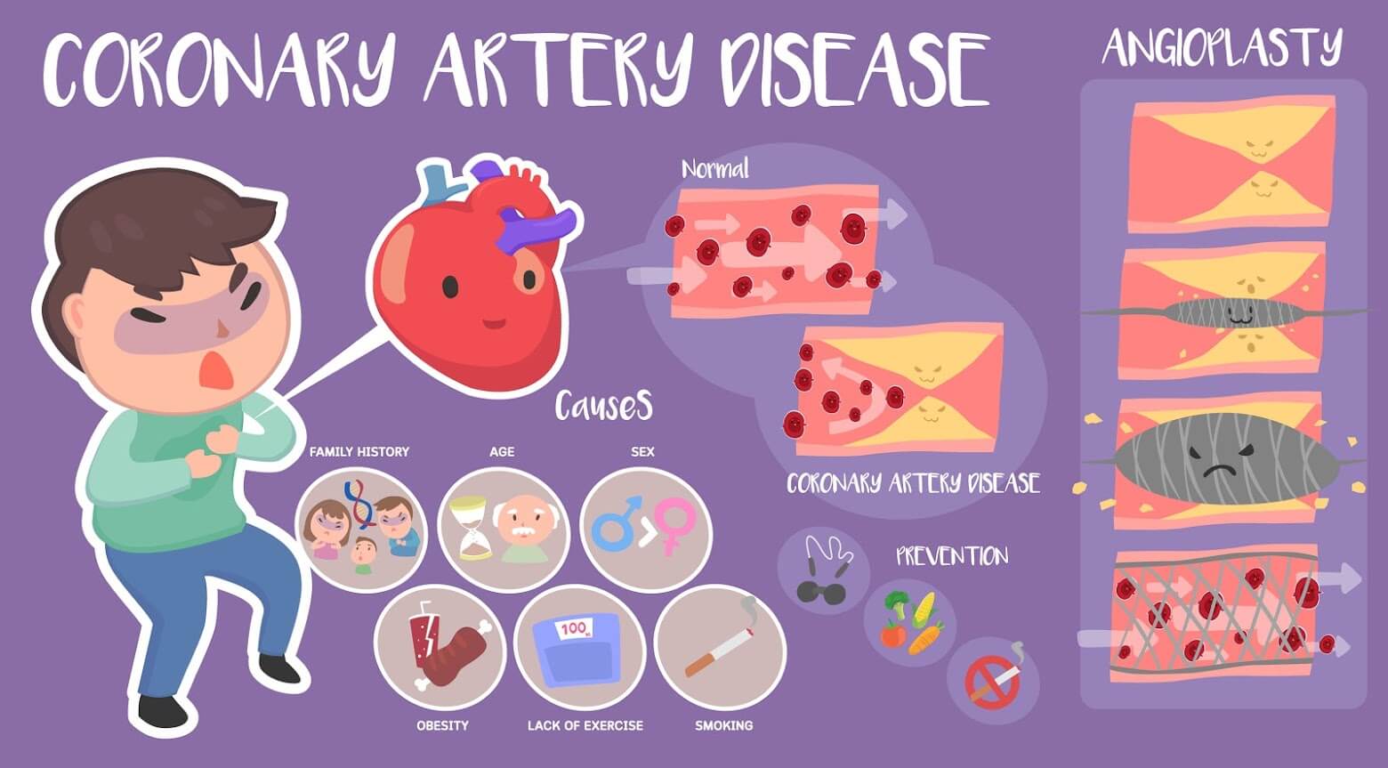 Coronary Artery Disease - Cardiac Screen